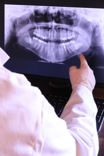 Best Emergency Dental Care for Broken or Chipped Teeth in Salem, WV