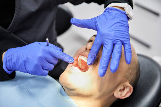 Best Emergency Dental Care for Broken or Chipped Teeth in Salem, WV