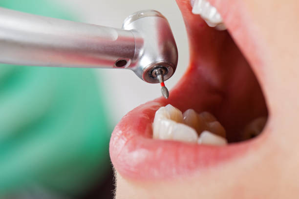 Best Emergency Treatment for Dental Infections or Abscesses in Salem, WV